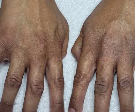 Marinau2019s Skin Health