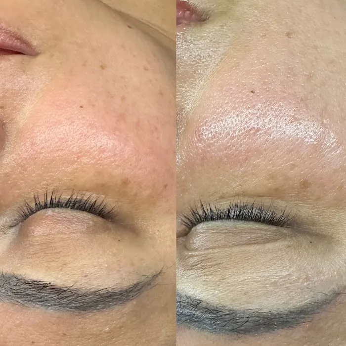 Glowgeous Skin Beauty & Aesthetics Picture 5