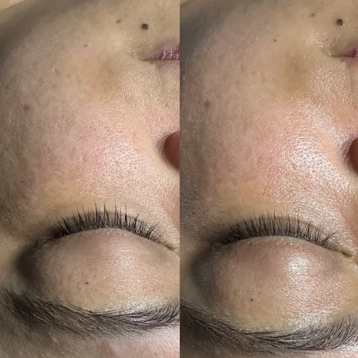 Glowgeous Skin Beauty & Aesthetics Picture 10