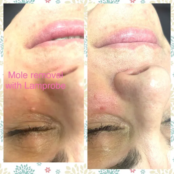 Flawless Skin by Toni At La Bella Picture 10