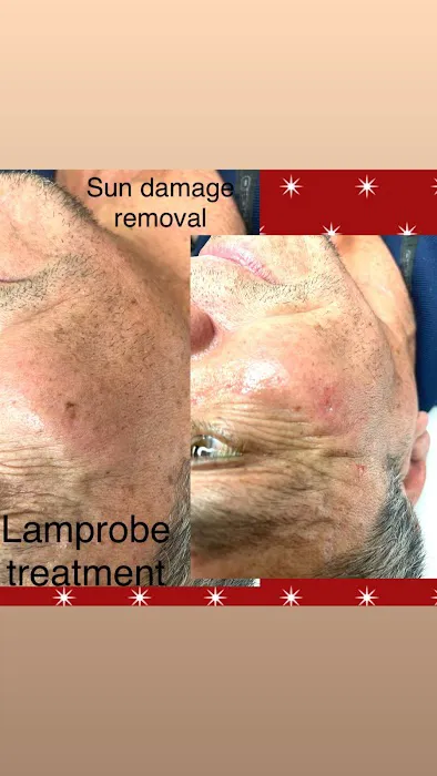 Flawless Skin by Toni At La Bella Picture 8