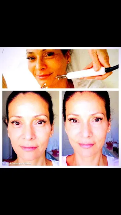 BlushLA Skincare Picture 6