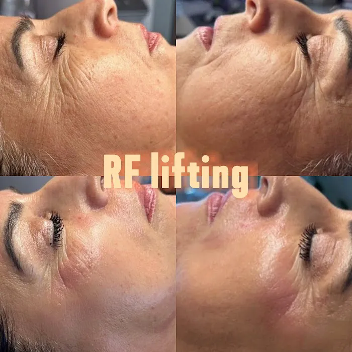 Dreamlook Beauty Picture 9