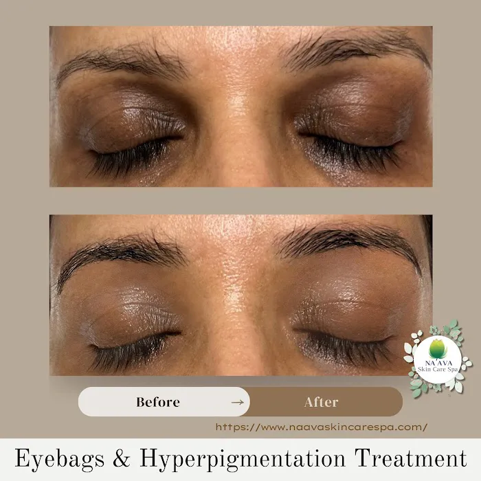 Na'ava Skin Care Spa Picture 5