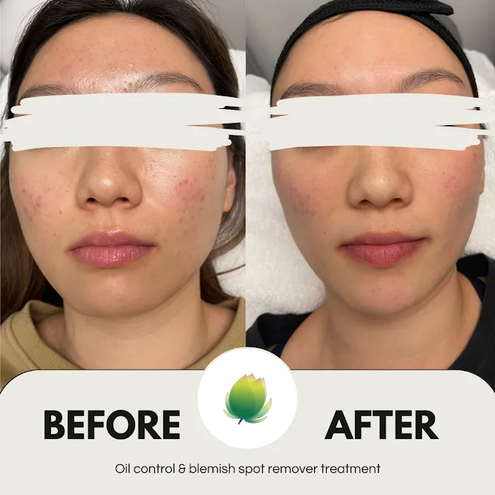 Na'ava Skin Care Spa Picture 9