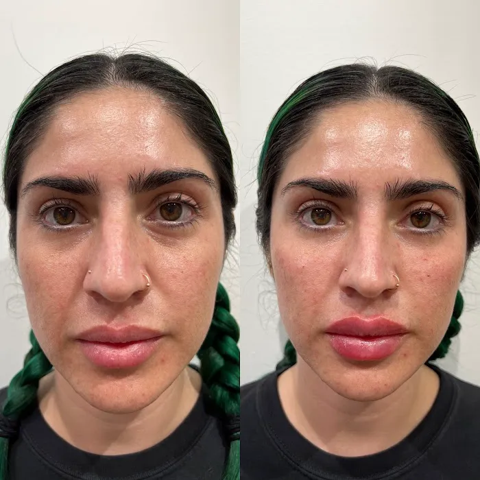 True Essence Medical Aesthetics Picture 2