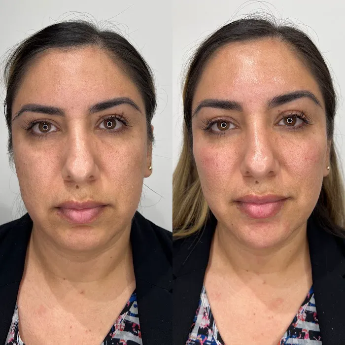 True Essence Medical Aesthetics Picture 6