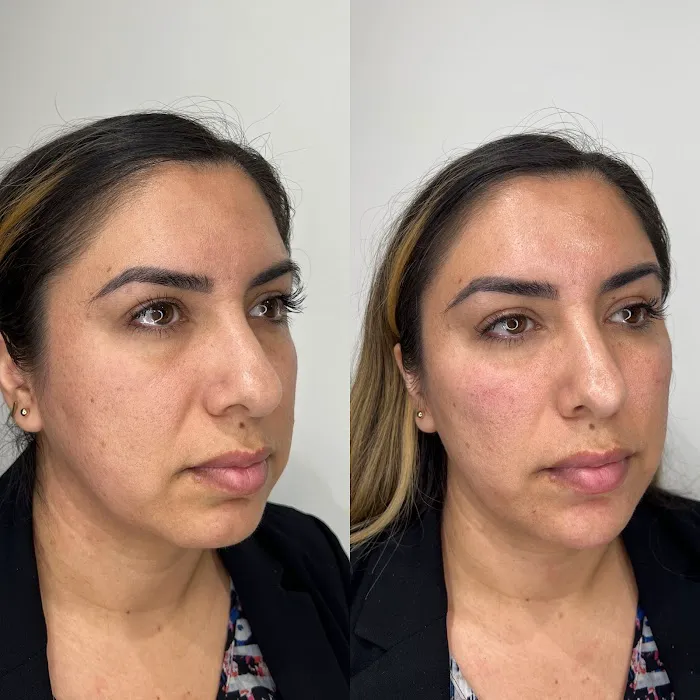 True Essence Medical Aesthetics Picture 4