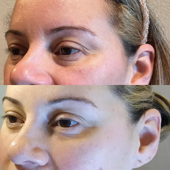 True Essence Medical Aesthetics Picture 5