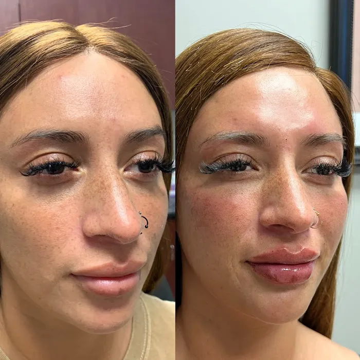 True Essence Medical Aesthetics Picture 7