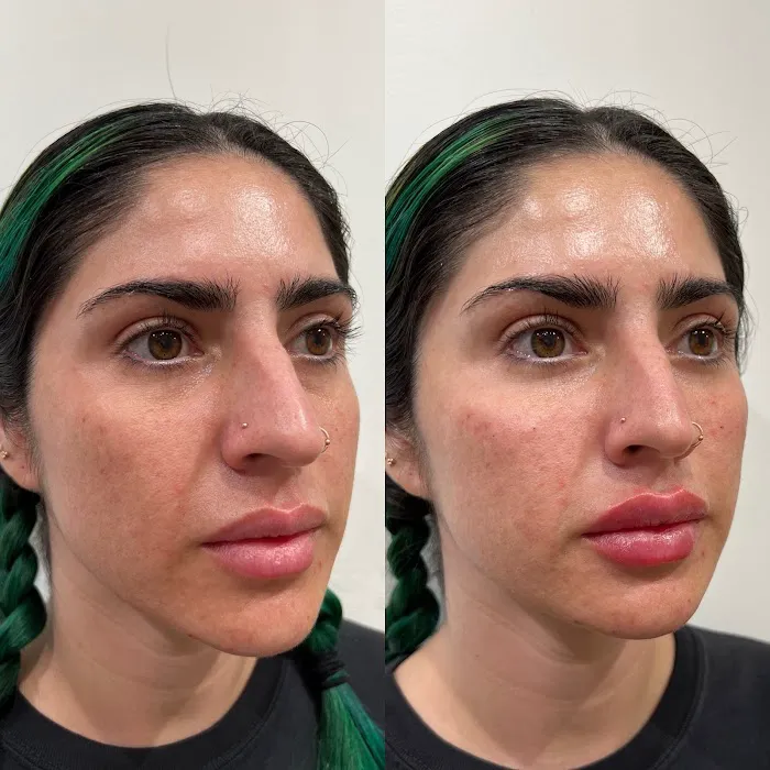 True Essence Medical Aesthetics Picture 8