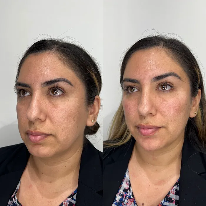 True Essence Medical Aesthetics Picture 9