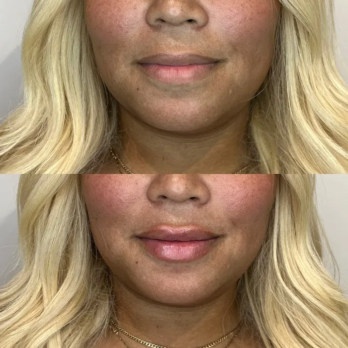 True Essence Medical Aesthetics Picture 10