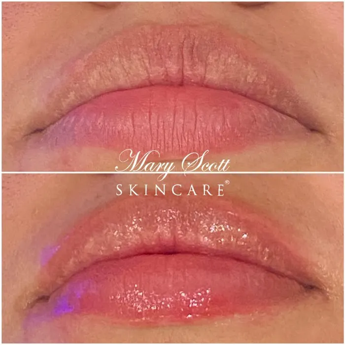 Mary Scott Skincare Picture 1