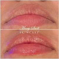 Mary Scott Skincare ico