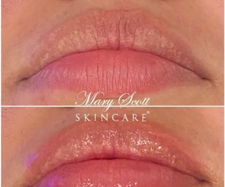 Mary Scott Skincare