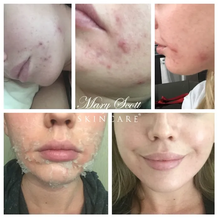 Mary Scott Skincare Picture 2