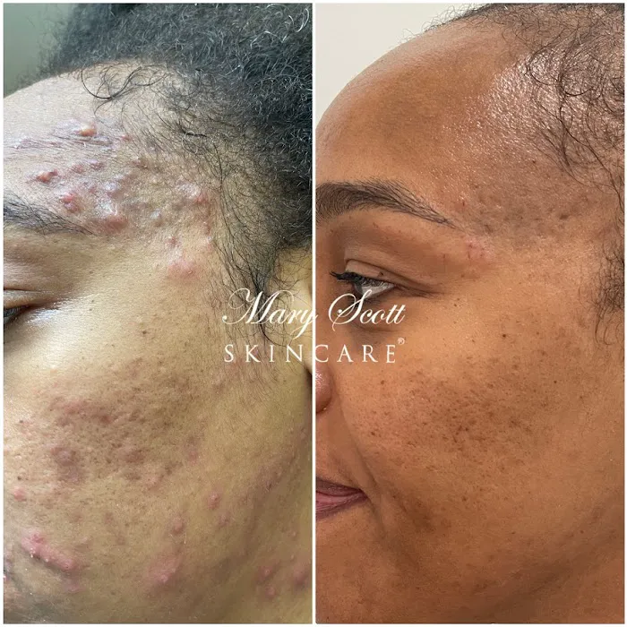 Mary Scott Skincare Picture 6