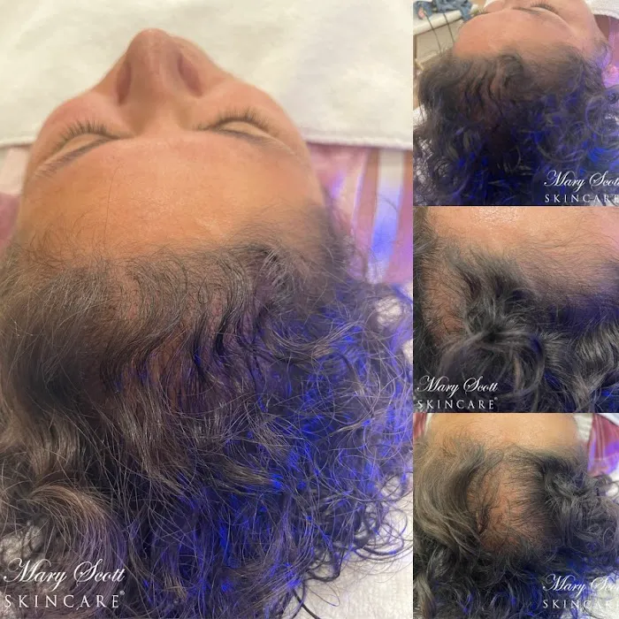 Mary Scott Skincare Picture 9