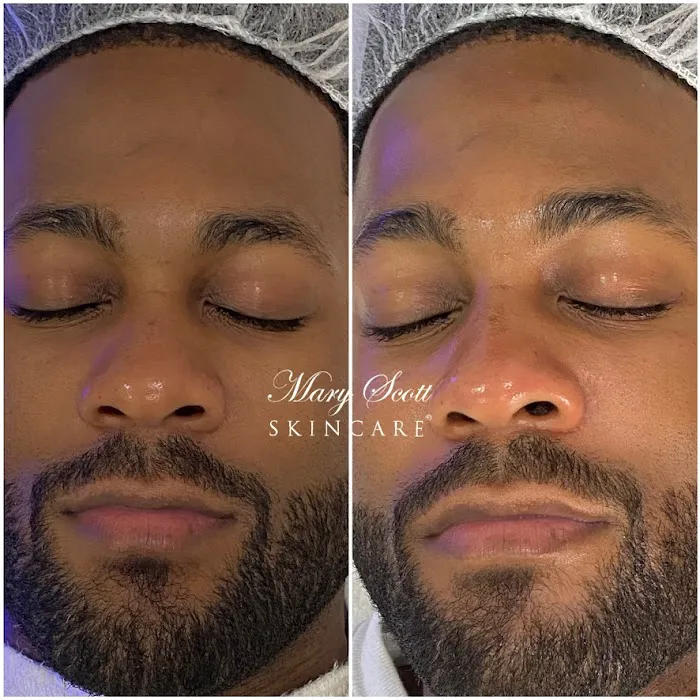 Mary Scott Skincare Picture 3