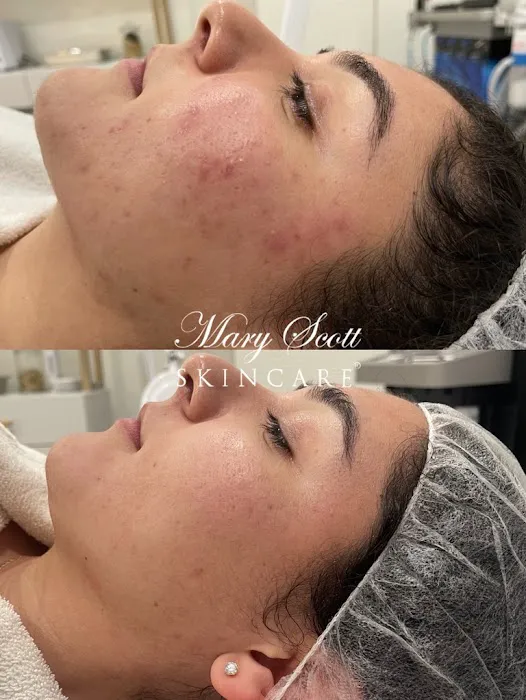 Mary Scott Skincare Picture 8