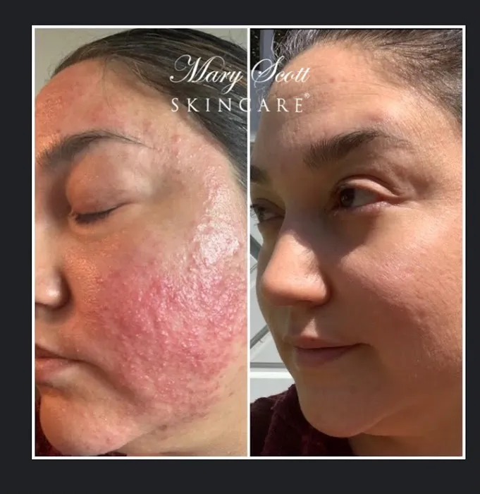 Mary Scott Skincare Picture 5