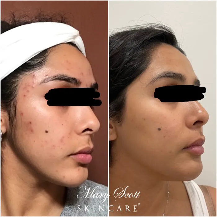 Mary Scott Skincare Picture 7