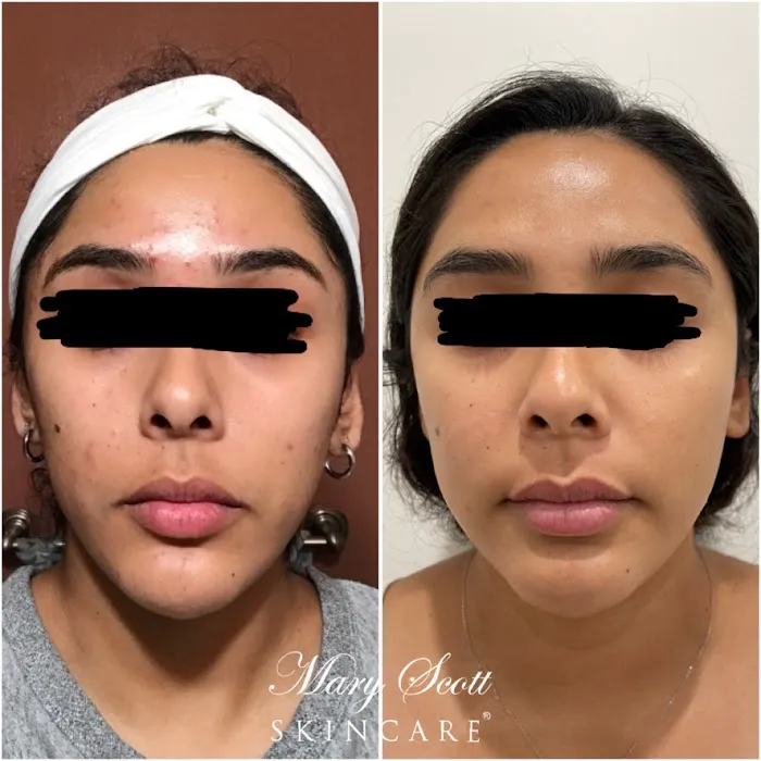 Mary Scott Skincare Picture 4