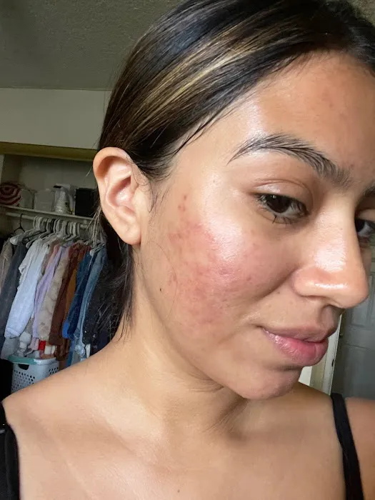 CCcorective Skincare Picture 2