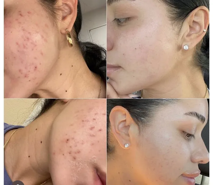 CCcorective Skincare Picture 4