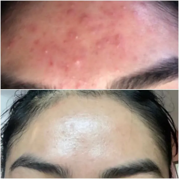 CCcorective Skincare Picture 7