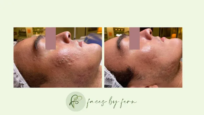 Faces by Fern Picture 4