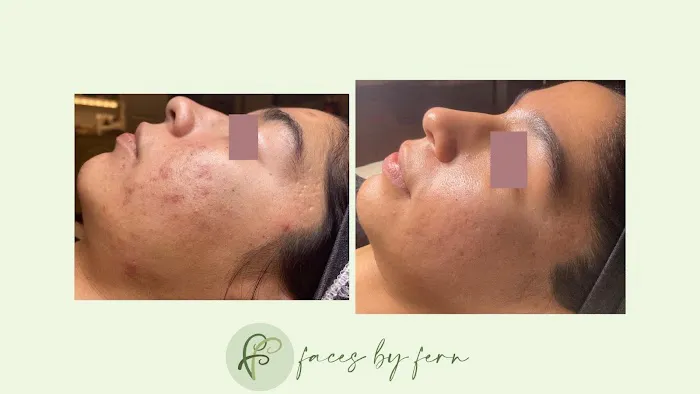 Faces by Fern Picture 5