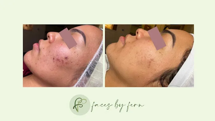 Faces by Fern Picture 7