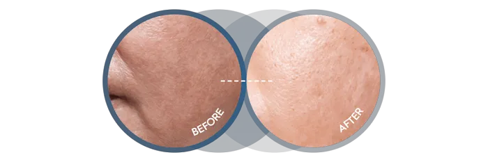 Skin by Alicia Picture 7