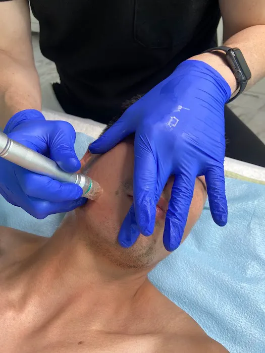 Saint Michel Esthetics Picture 9