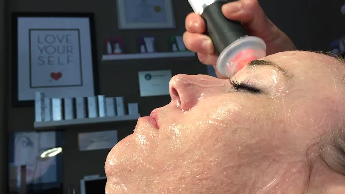 About Skin Picture 8