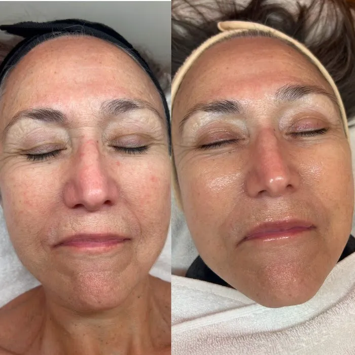 Skincare By Della Picture 5