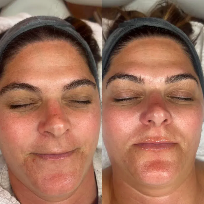 Skincare By Della Picture 7