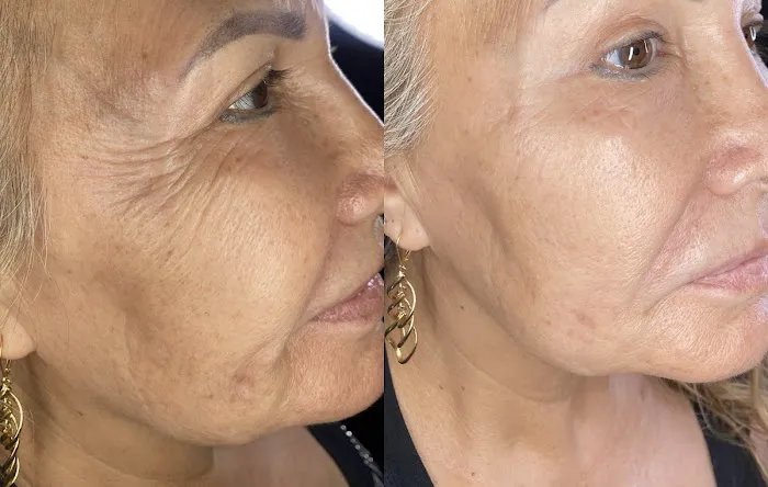 Bellami Luxe Picture 1