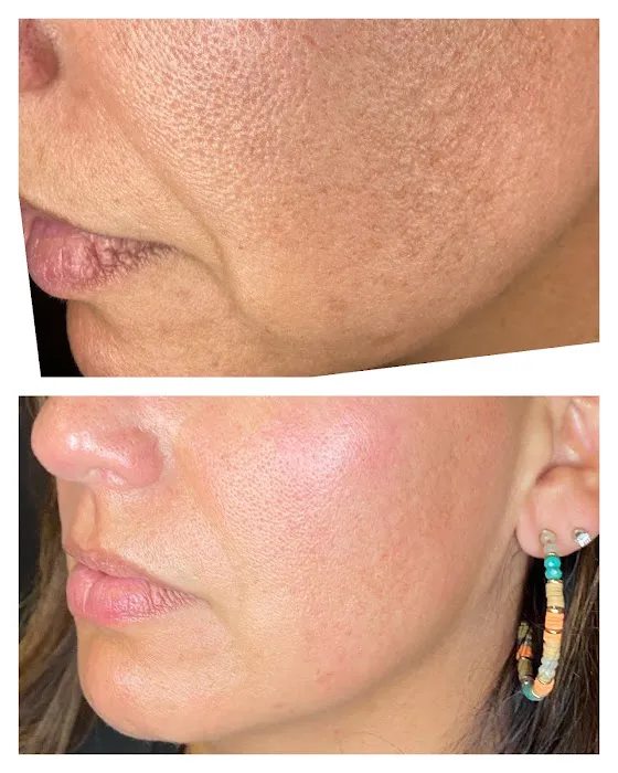 Bellami Luxe Picture 2