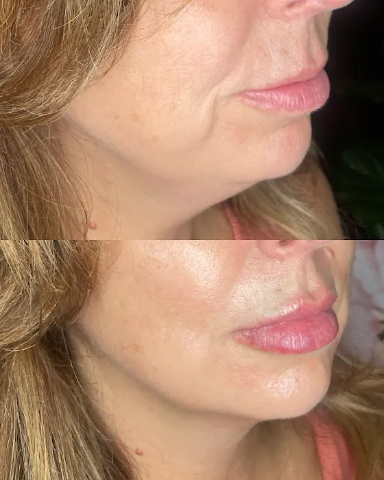 Bellami Luxe Picture 8