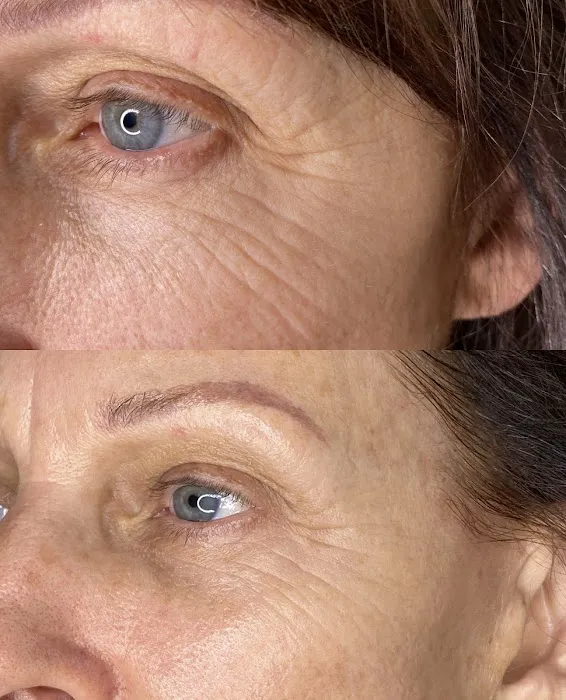 Bellami Luxe Picture 3