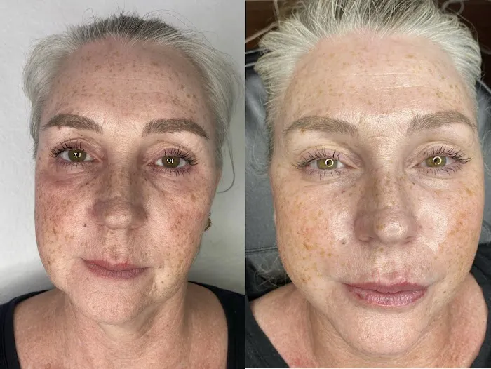 Bellami Luxe Picture 4