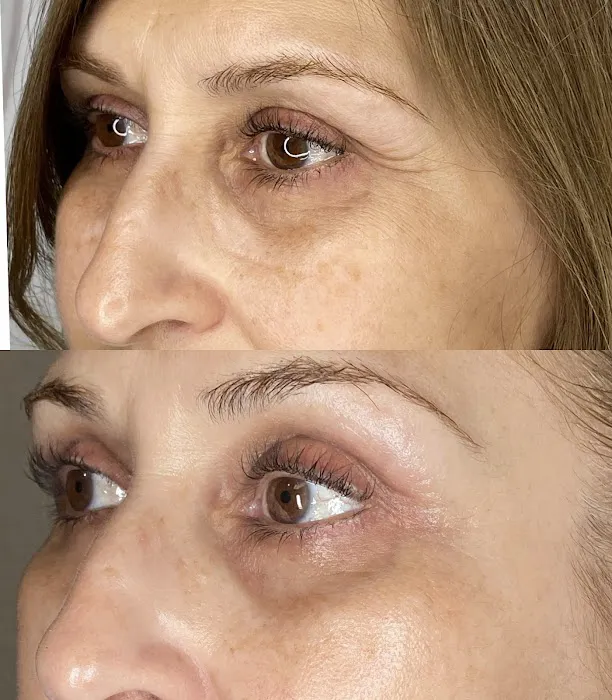 Bellami Luxe Picture 7