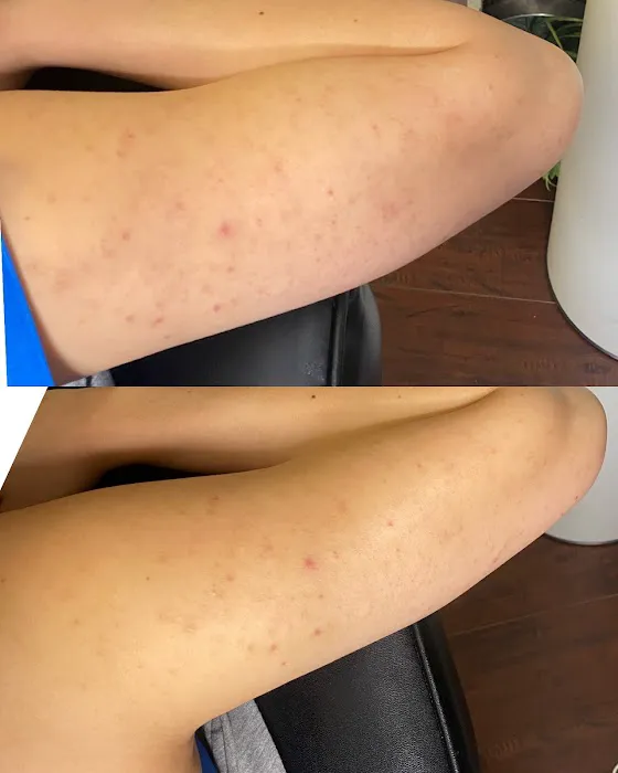 Bellami Luxe Picture 5