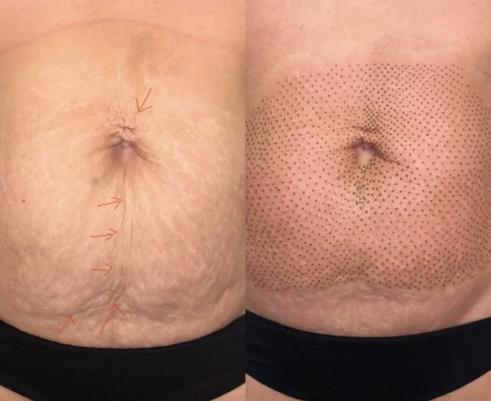 Bellami Luxe Picture 10