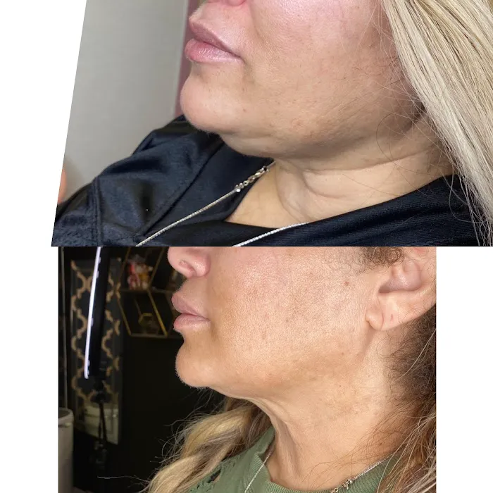 Bellami Luxe Picture 9