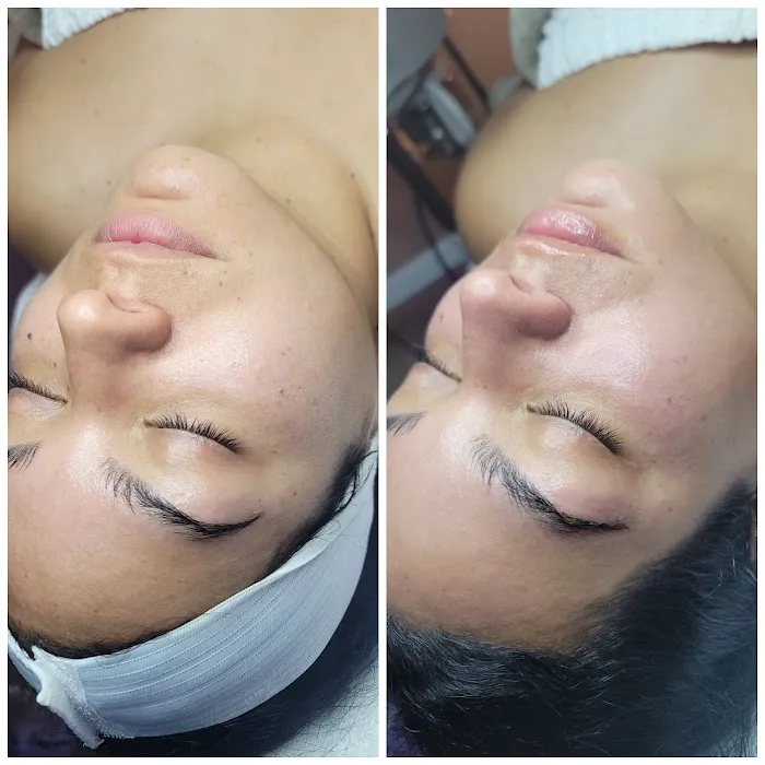 Skin Karma Picture 4