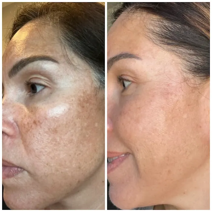 Skin Karma Picture 3